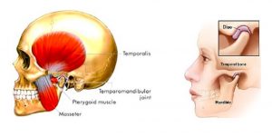 TMJ-SleepApneaCo